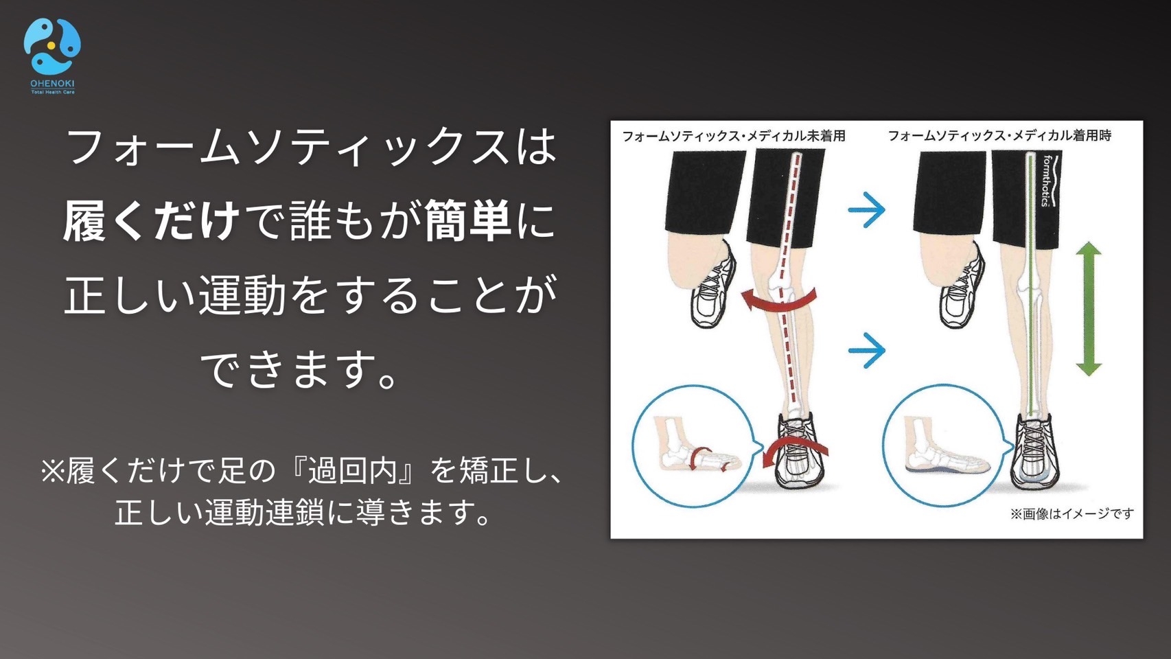 フォームソティックスは履くだけで誰でもが簡単に正しい運動をすることができます。