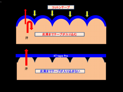 テープ