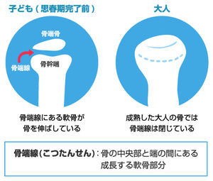 骨端線